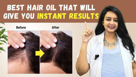 Ayurvedic Natural Remedies to Stop Hair Fall