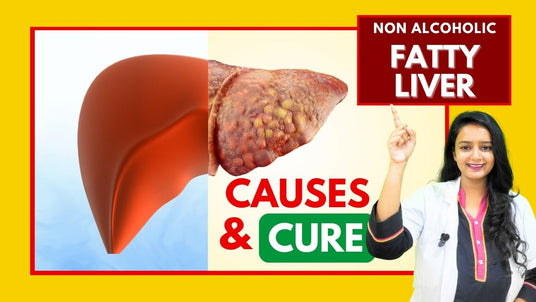 Non Alcoholic Fatty Liver 